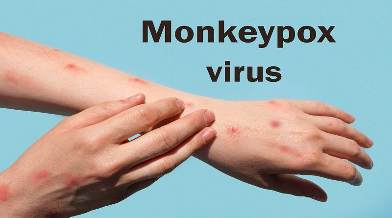 Monkey Fever Sri Lanka's first monkey fever patient reported - The Colombo Post
